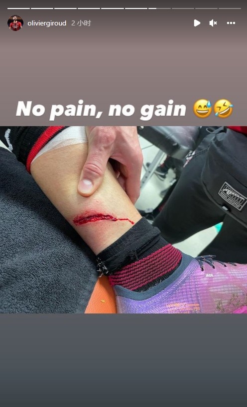 吉鲁赛后晒受伤部位:没有伤痛就没有收获